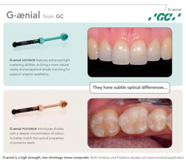 GC G Aenial Anterior Alpha Dentkart