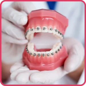 Orthodontics - Alpha Dentkart