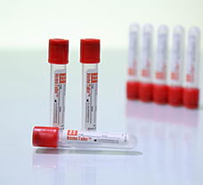 blood collection tube non vacuum clot activator ml 1579846303 - Alpha Dentkart